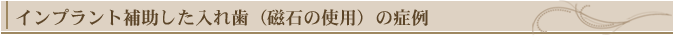 インプラント補助した入れ歯(磁石使用)の症例