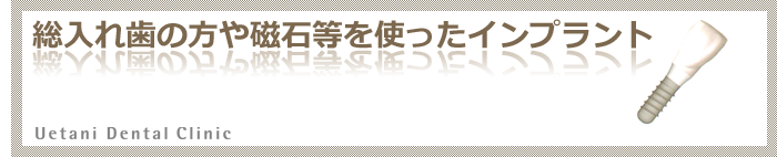 総入れ歯の方や磁石等を使ったインプラント