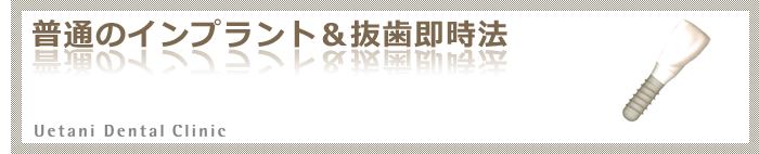 普通のインプラントと抜歯即時法
