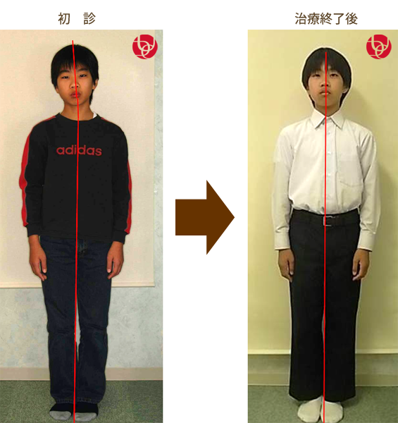 噛み合わせは全身のバランスに関与