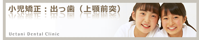 小児矯正歯科(歯列育形成):出っ歯(上顎前突)