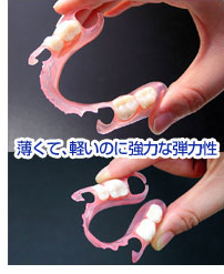ノンクラスプデンチャー