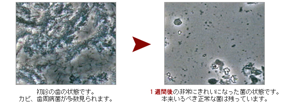 アンケート