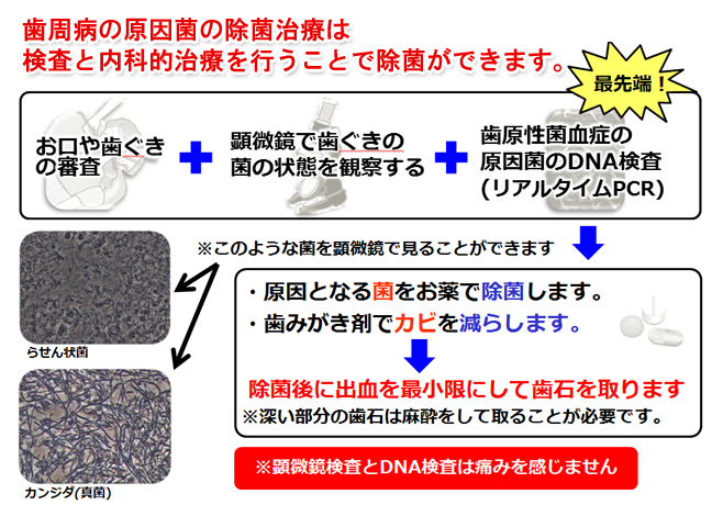 除菌治療について