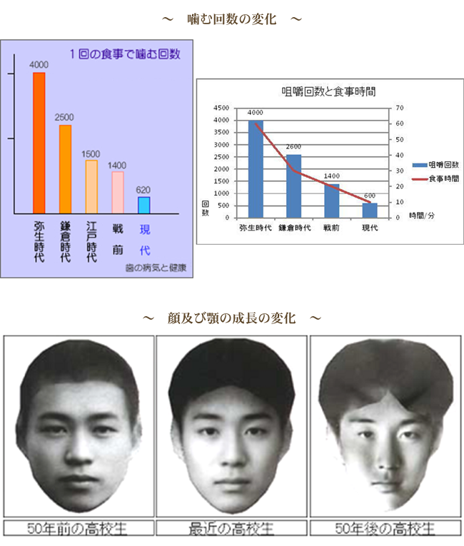 現代の子供さんの顎の未発達の現状