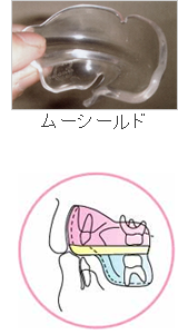 ムーシールド