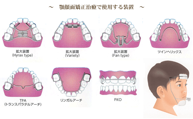 現代の子供さんの顎の未発達の現状