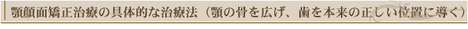 顎顔面矯正治療の具体的な治療法(顎の骨を広げ、歯を本来の正しい位置に導く)