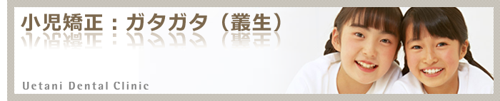 小児矯正歯科(歯列育形成):ガタガタ(叢生)