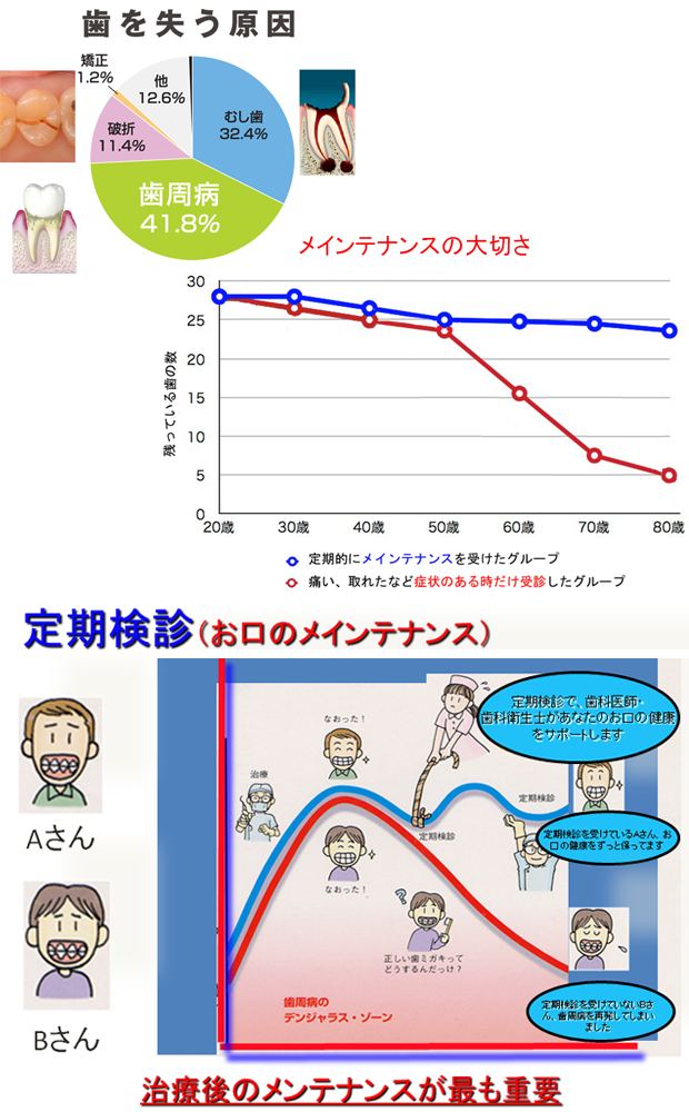 定期検診により歯を失う原因を大きく下げることができます