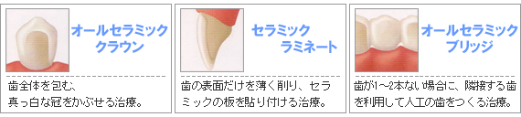 各種セラミック